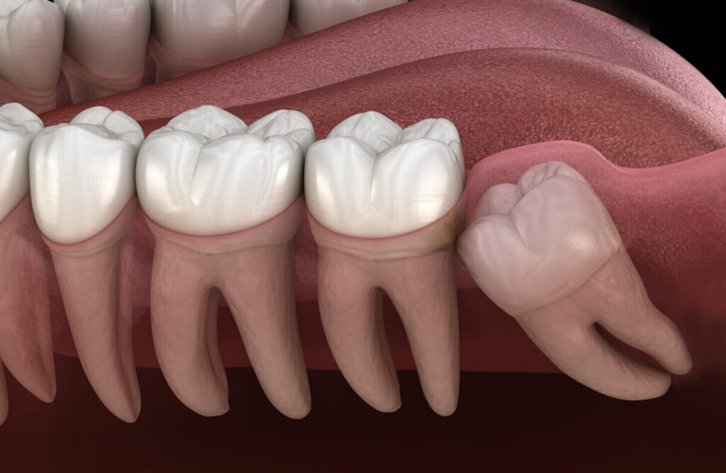 https://puresmilesdental.in/wp-content/uploads/2024/02/dentic-1024x667-1.jpg