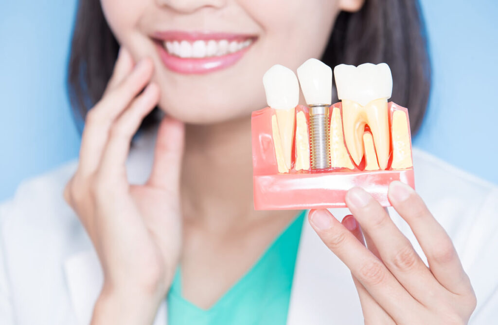 https://puresmilesdental.in/wp-content/uploads/2024/02/implant-1024x667-1.jpg