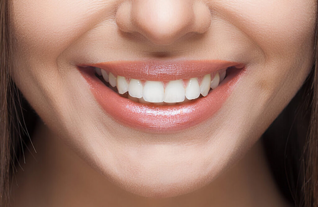 https://puresmilesdental.in/wp-content/uploads/2024/02/smile-1024x667-1.jpg